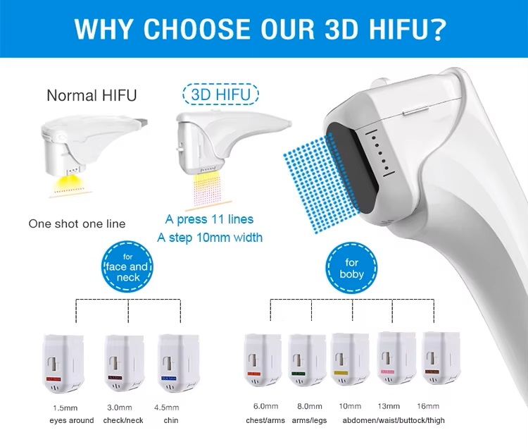 3D HIFU