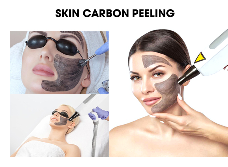 IPL SHR YAG hair removal