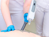 Professional Yag Laser Tattoo Removal Machine for Sale​