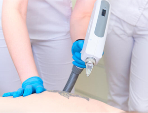 Professional Yag Laser Tattoo Removal Machine for Sale​