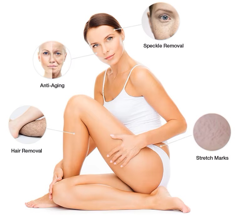 IPL SHR Hair Removal