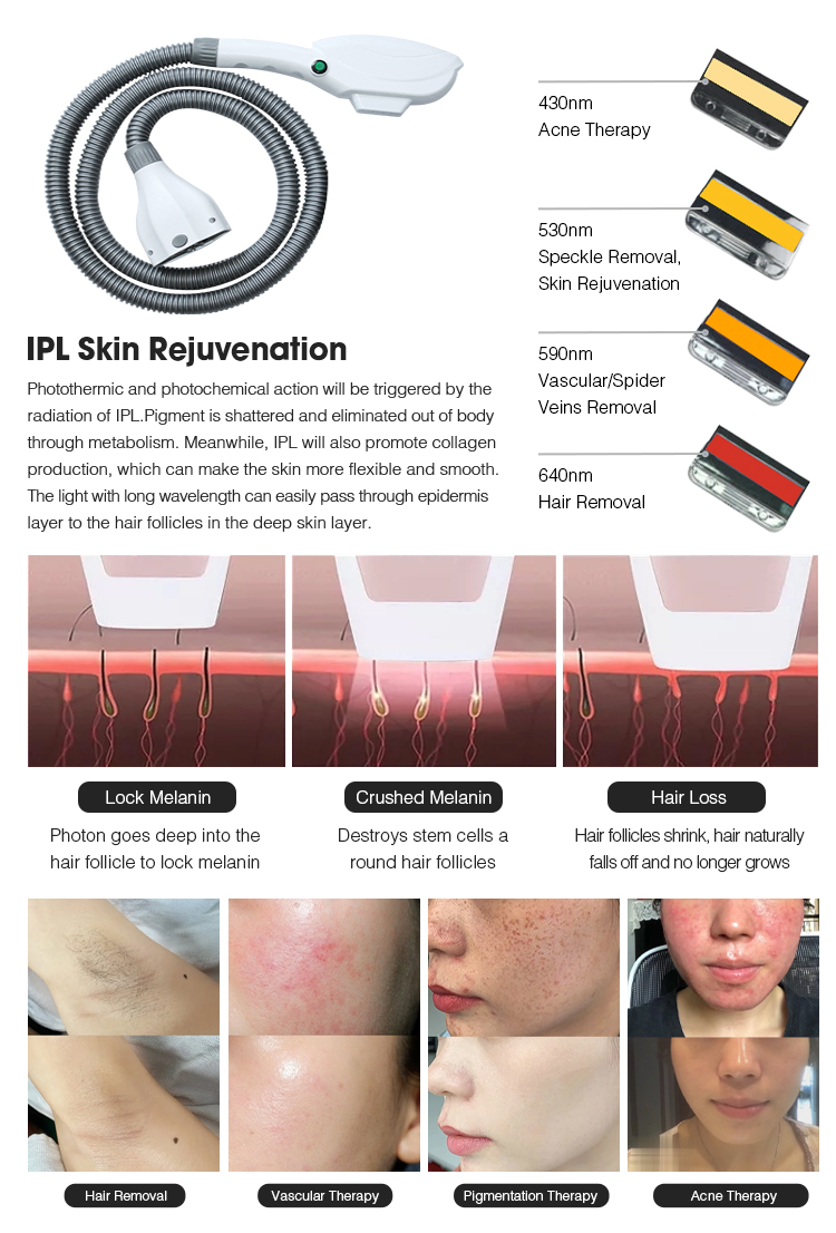 IPL SHR Hair Removal