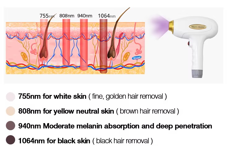 Diode Laser Hair Removal Machine