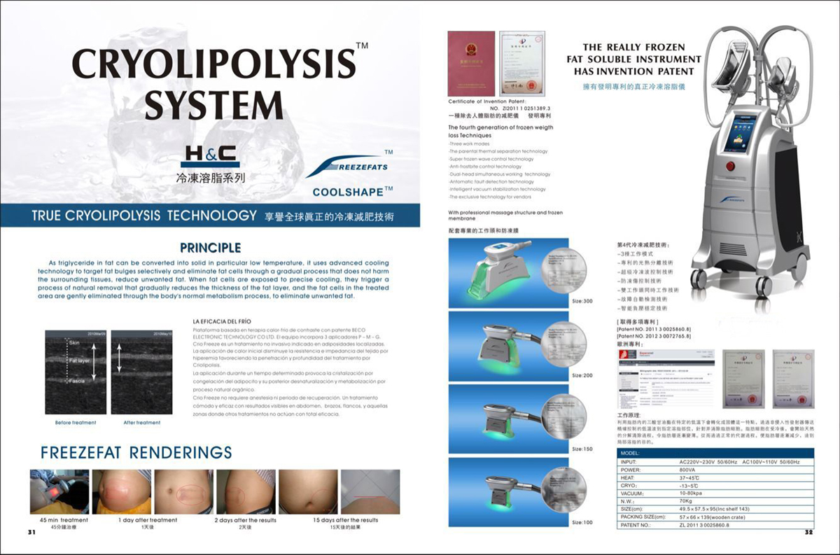 cryolipolysis fat freeze