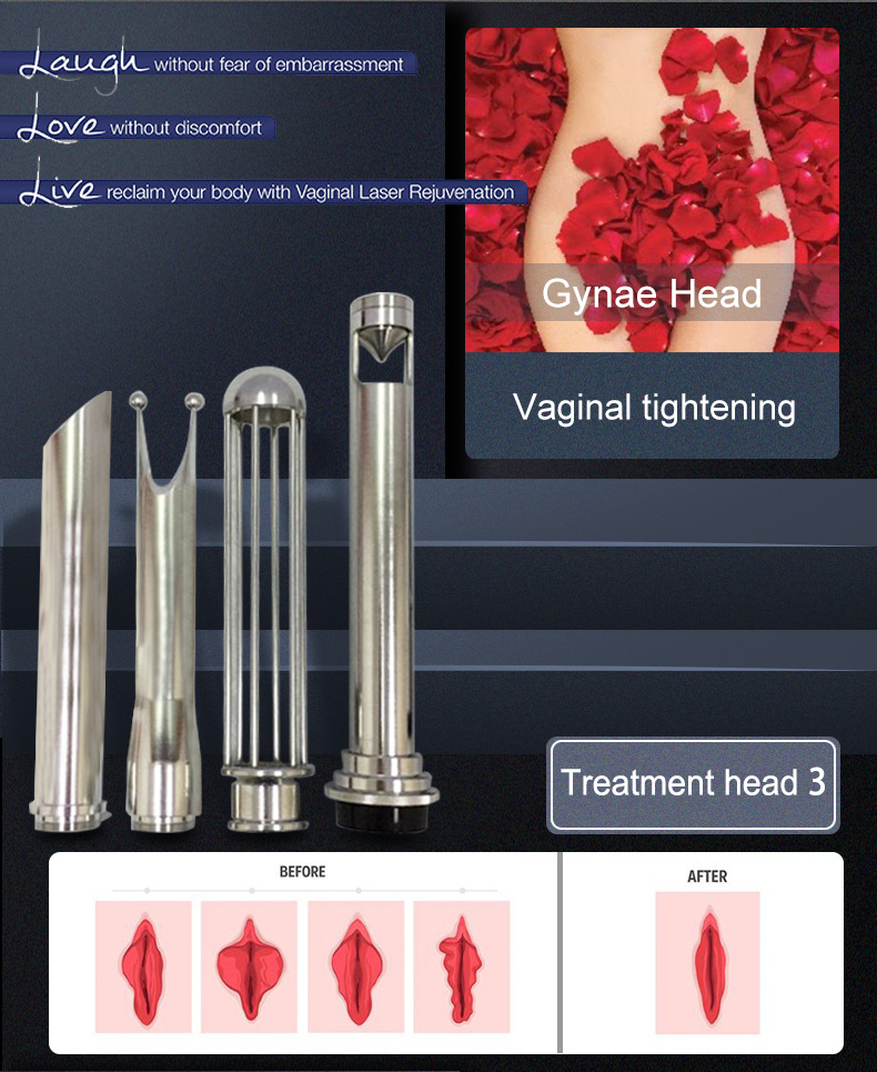 10600nm fractional co2 laser