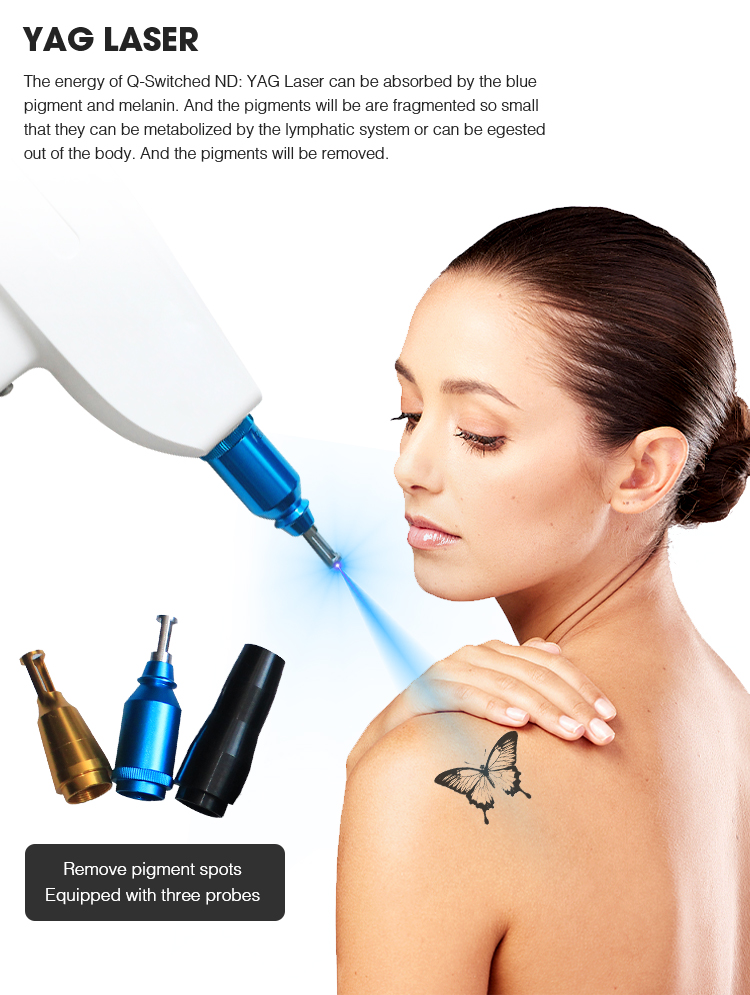 SHR YAG hair removal