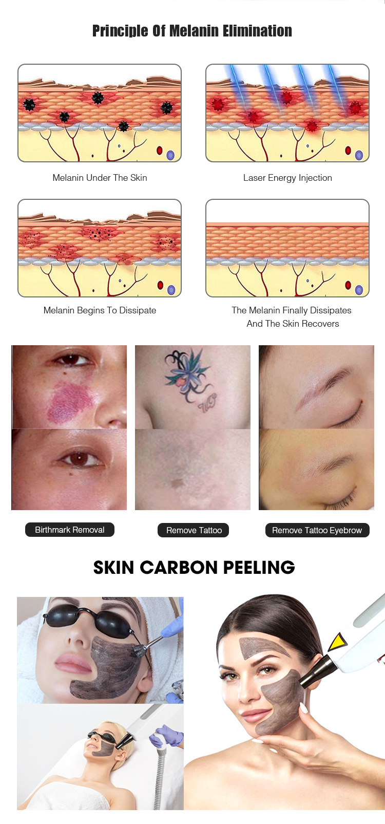 SHR IPL YAG RF Laser Hair Removal Machine