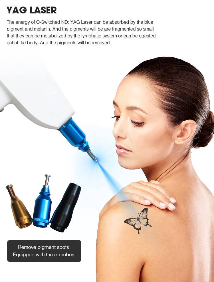 SHR IPL YAG RF Laser Hair Removal Machine