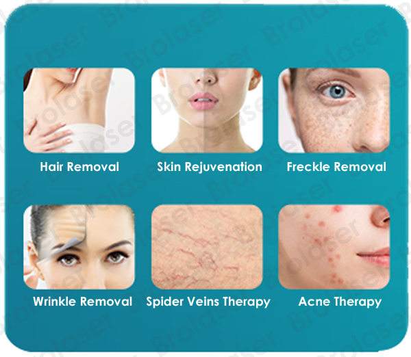 IPL SHR Hair Removal