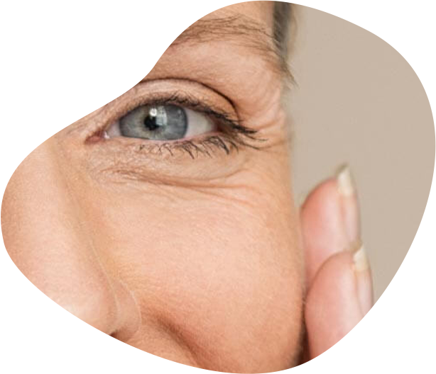 WRINKLE REMOVAL