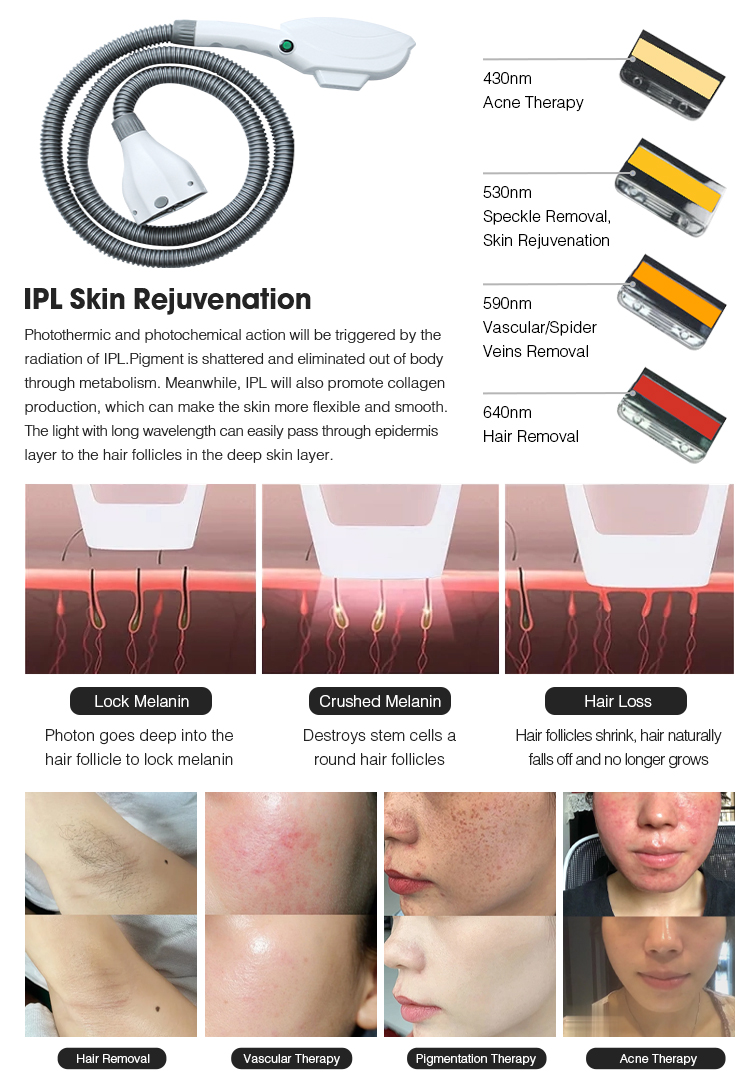 IPL SHR YAG hair removal