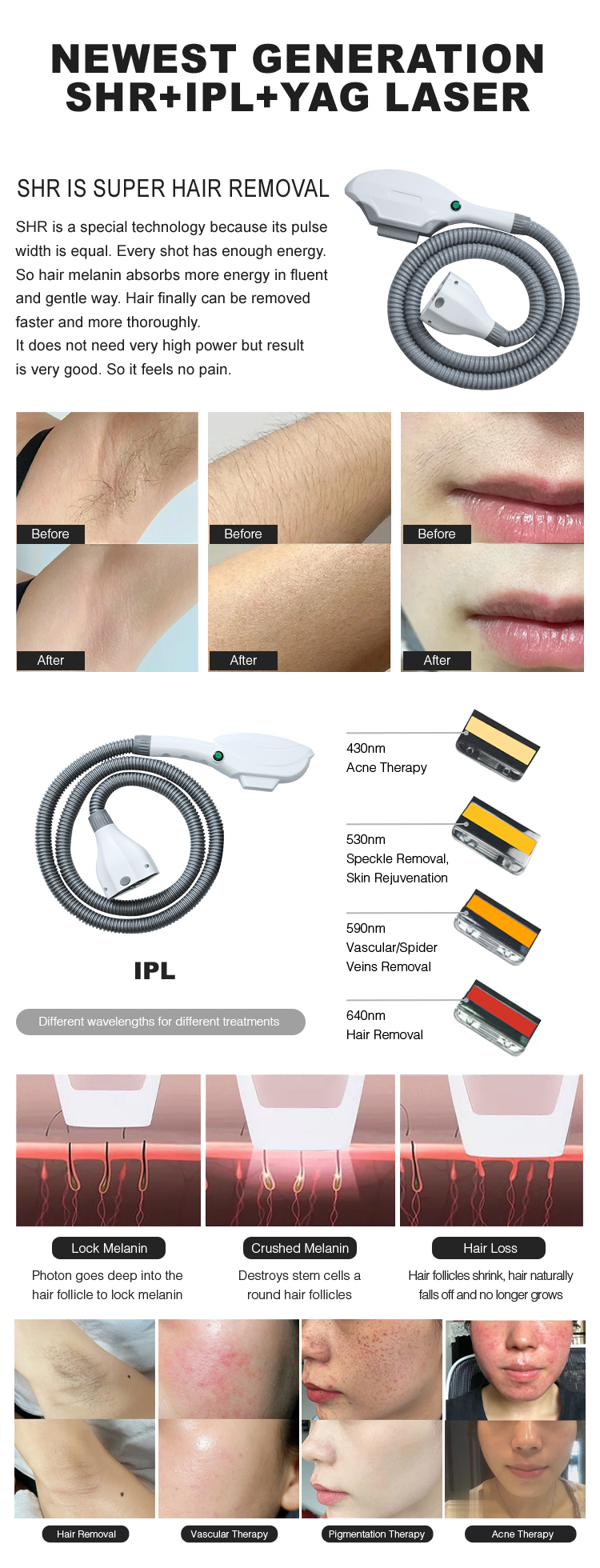 IPL SHR hair removal